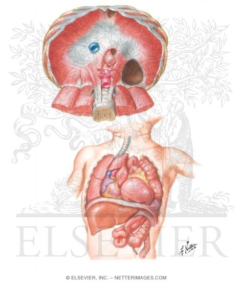 Congenital Diaphragmatic Hernia