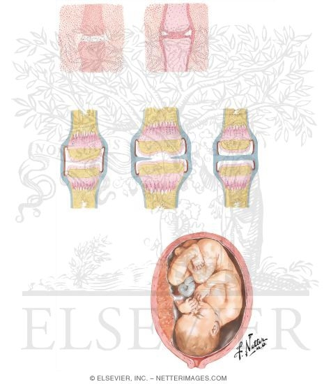 Development of Three Types of Diathrodial (Synovial) Joints