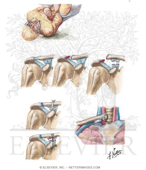 Sternoclavicular Joint