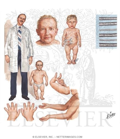 Metaphyseal Chondrodysplasias