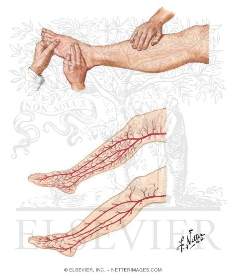 Acute Anterior Compartment Syndrome