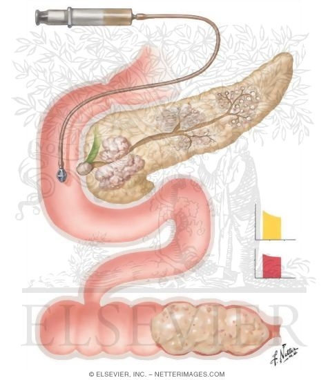 excretory system diseases. Excretory system diseases; Excretory system diseases. robbyx. Apr 25, 04:32 PM. Dig deeper Watson. Turning off location services DOES NOT disable this