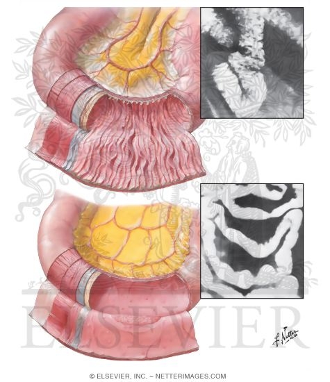Mucosa and Musculature of Small Intestine
Small Intestine Structure