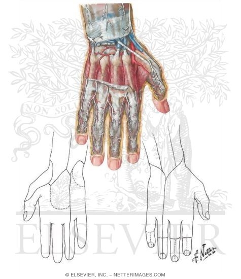 Effect On Hand of Radial, Median, and Ulnar Lesions