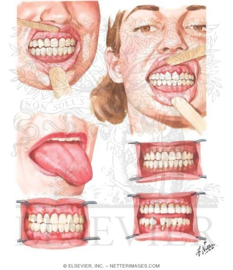 Oral Manifestations Related to Endocrine System