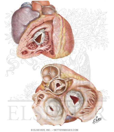 Rheumatic Heart Disease XII - Tricuspid Stenosis and Insufficiency