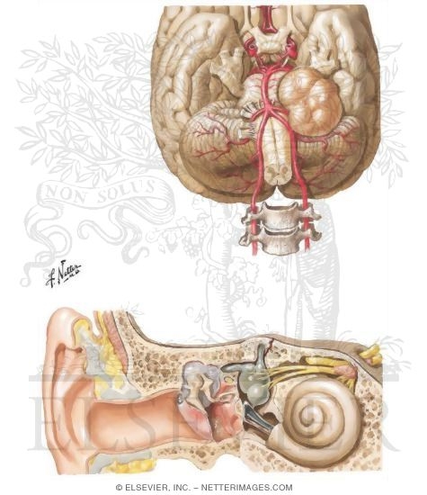 The Many Pathologic Causes of Vertigo
