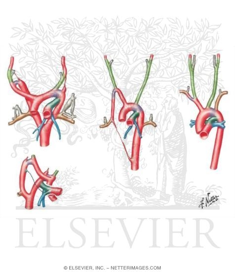 Development of the Major Blood Vessels