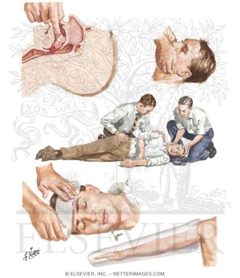 First Aid Treatment of the Head-Injured Patient