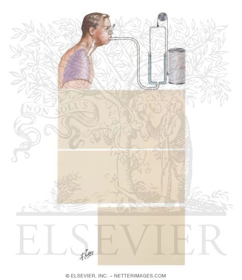 Forced Expiratory Vital Capacity Maneuver
