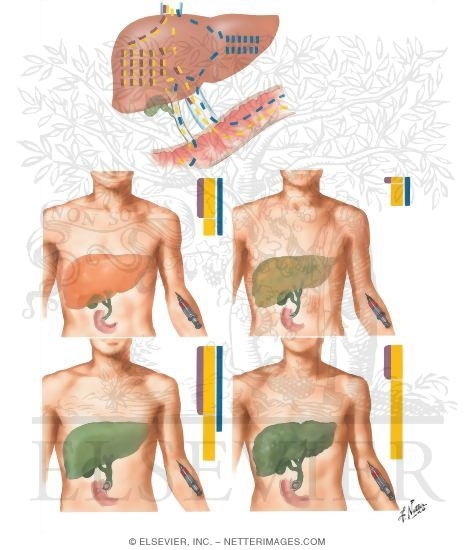 Cholesterol and Phospholipid Blood Levels
