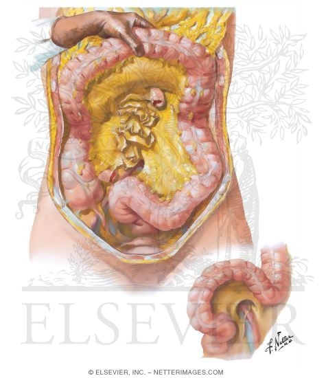 58059 3 Adrenal Anatomy and Blood Supply of the Adrenal Glands 69
