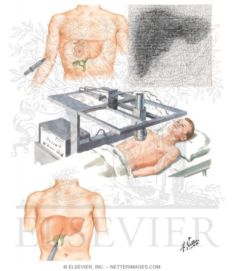 Liver Scanning and Transhepatic Cholangiography