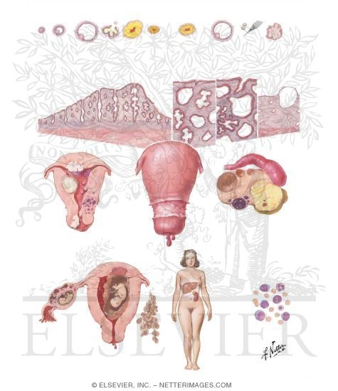  ... pathologic causes of uterine bleeding category smith 2e category smith