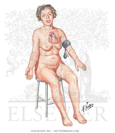 Clinical Manifestations of Hypothyroidism in Adults