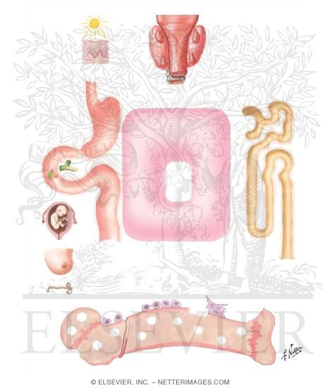 Osteomalacia (Rickets) of Alimentary Origin