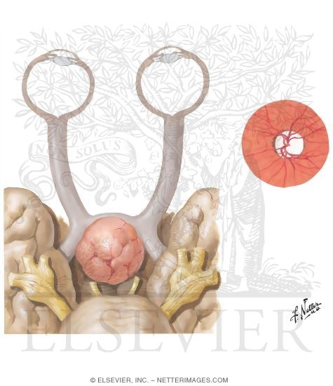Effects of Pituitary Tumors on the Visual Apparatus