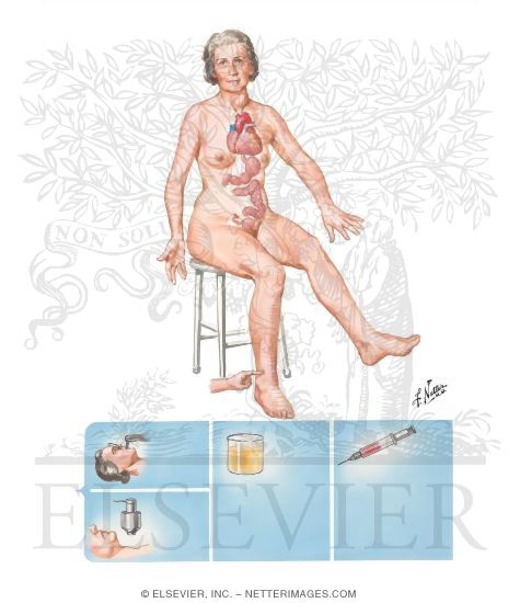 Signs and Symptoms of Toxic Adenoma