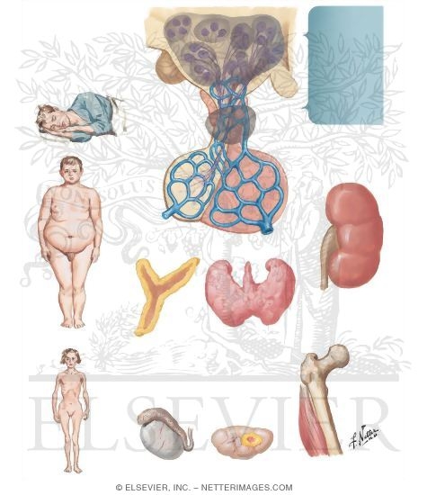 Manifestations of Suprasellar Disease