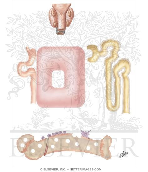 Osteomalacia (Rickets) of Renal Origin