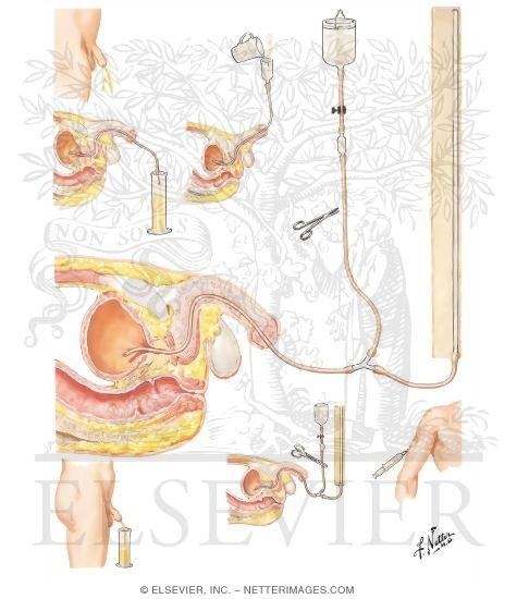 Bladder Capacity Men 42