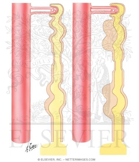 Diuretics - Mercurial Diuretics; Carbonic Anhydrase Inhibitors