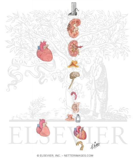 Etiology of Hypertension. Other Versions of This Illustration