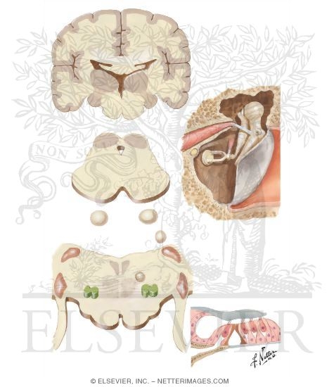 Centrifugal Auditory Pathways