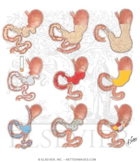 Factors Influencing Gastric Activitiy