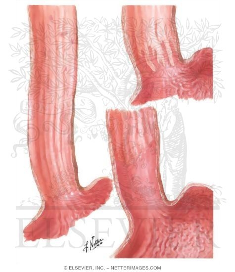 Congenital Anomalies