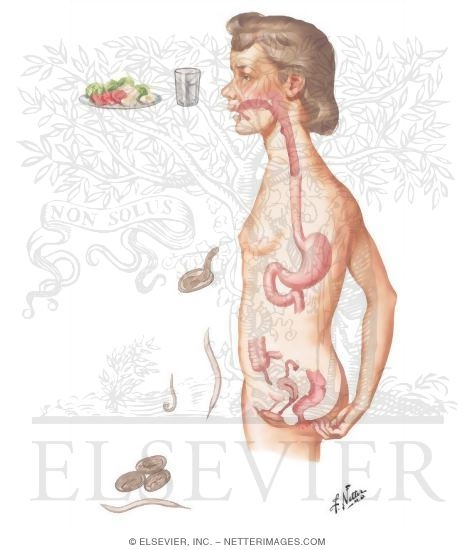 Parasitic Diseases III - Enterobiasis