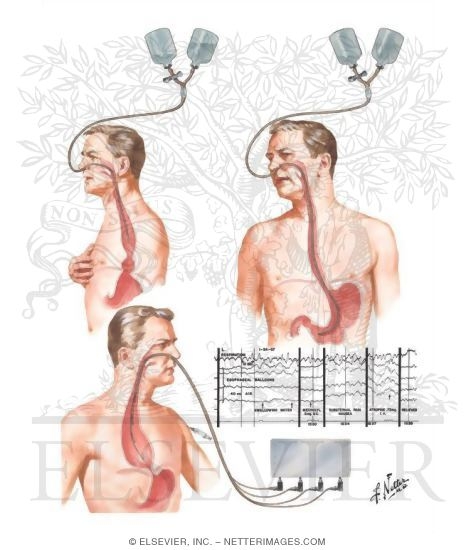 Diagnostic Aids in Esophageal and Gastric Disorders