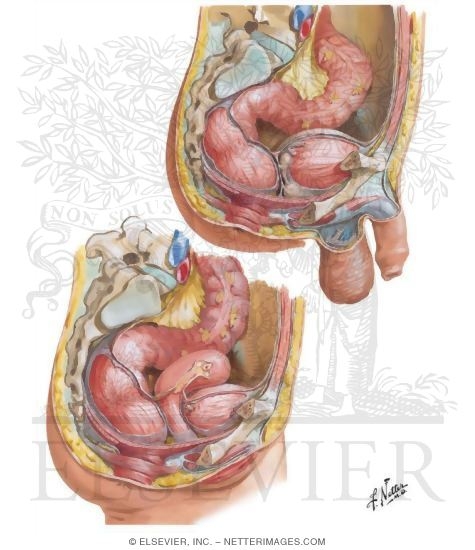 Rectum and Anal Canal - Topography, Course, and Relations
Rectum In Situ: Female and Male