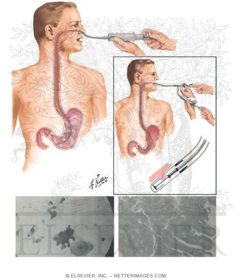 Cytologic Diagnosis