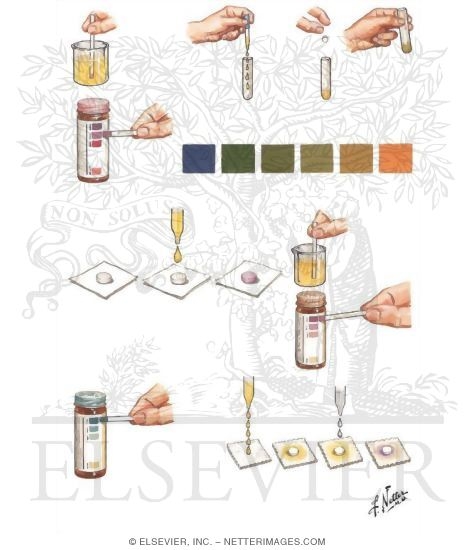 Urine Examination