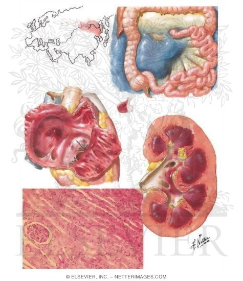 Viral symptoms in adults