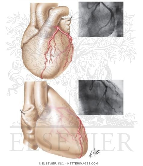 Coronary Arteries: Arteriographic Views