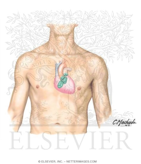 Cardiac Auscultation: Precordial Areas of Auscultation