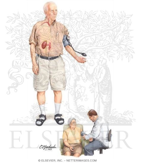 Hypertension in the Elderly