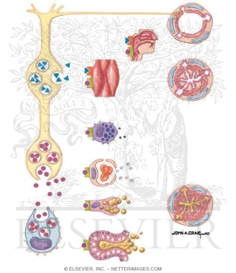 Airway Inflammation