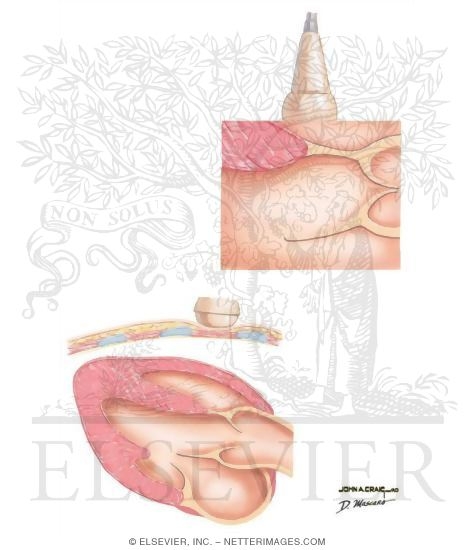 Ultrasound Imaging Modalities