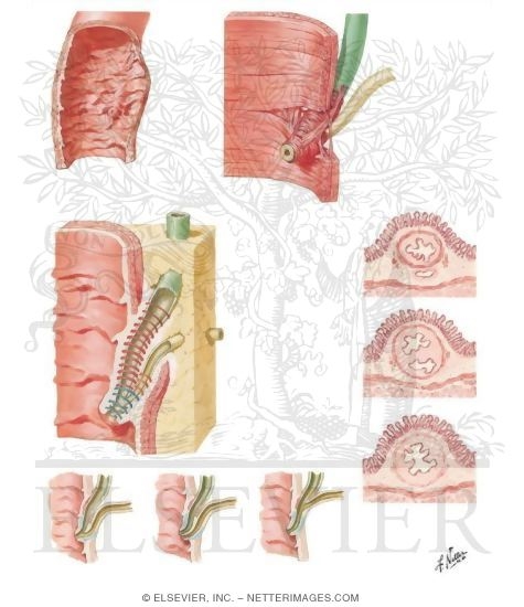 Choledochoduodenal Junction