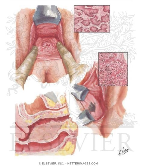 Malignant Tumors I - Primary