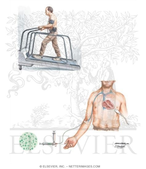 Exercise and Contrast Echocardiography