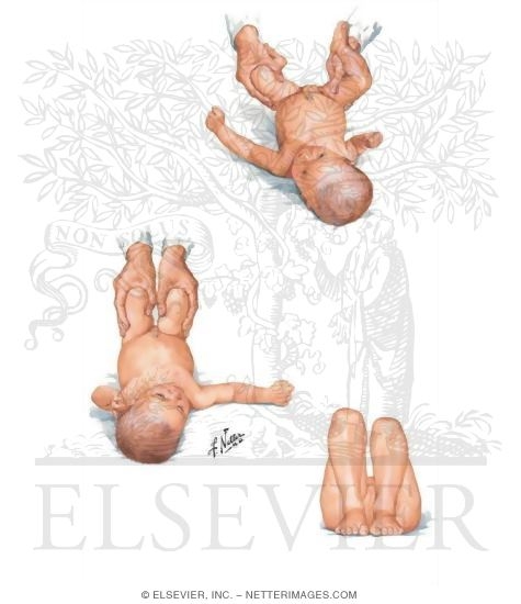 Physical Exam of the Thigh and Hip