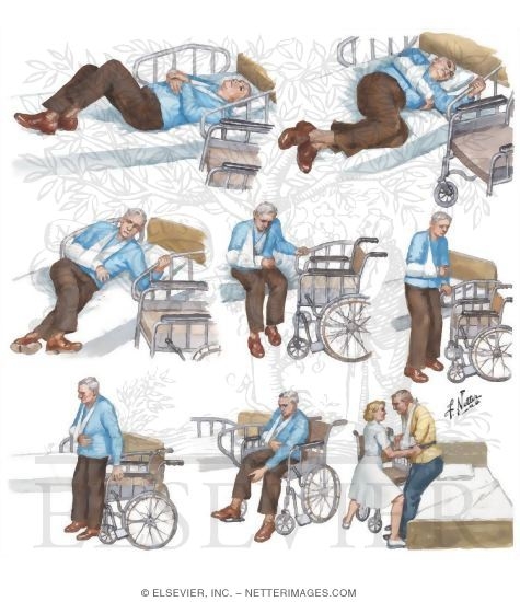 Transfer from Bed to Wheelchair After Stroke