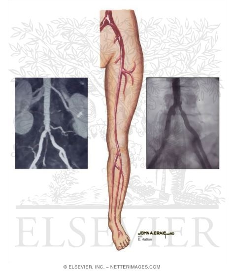 Diagnostic Techniques in Vascular Disease