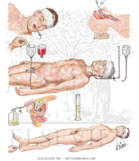 Initial Management of Severe Head Injuries