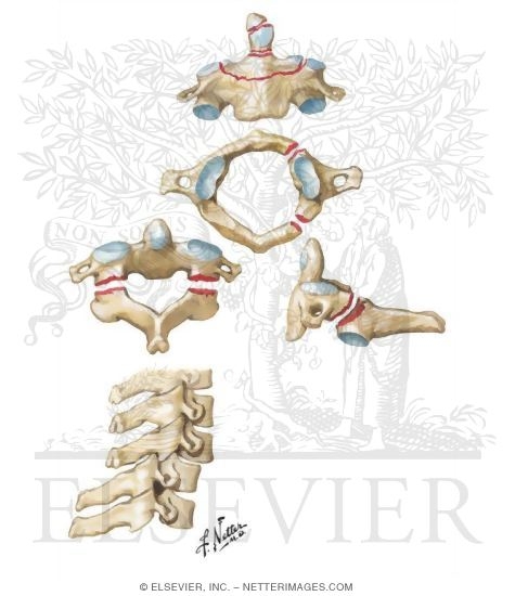 Fracture and Dislocation of Cervical Vertebrae
Trauma