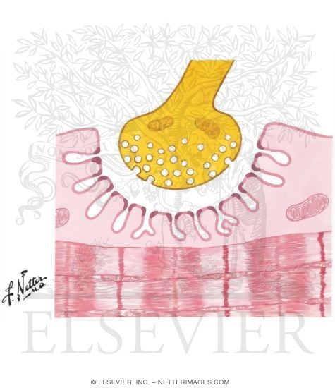 Myasthenia Gravis
